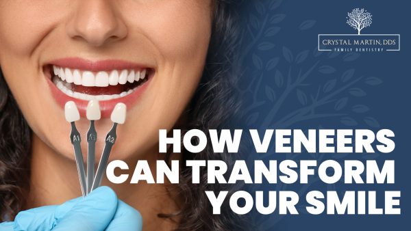 How Veneers Can Transform Your Smile (featured image)